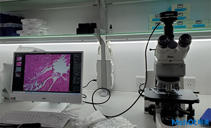 明美顯微鏡相機助力病理切片觀察
