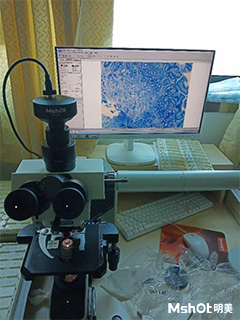 明美顯微鏡相機(jī)