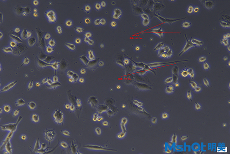 倒置顯微鏡下的細胞培養(yǎng)