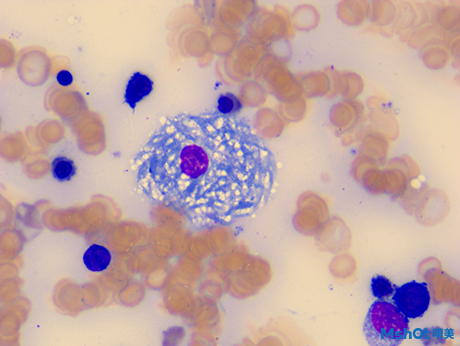 驚喜！明美顯微鏡相機拍下少見的類戈謝細胞