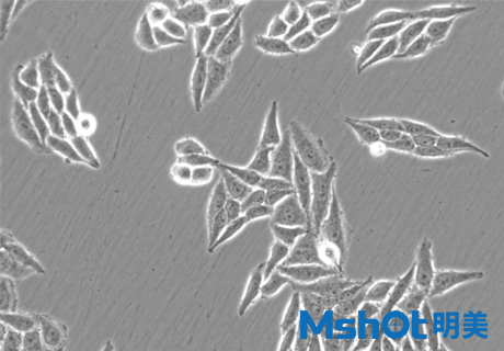 倒置顯微鏡MI52-N搭配顯微鏡MD60拍攝的乳腺癌細(xì)胞