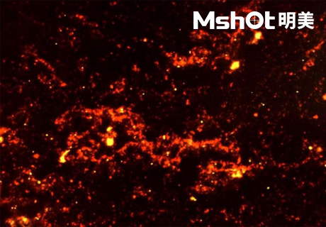 國產(chǎn)顯微鏡應(yīng)用于結(jié)核桿菌檢測