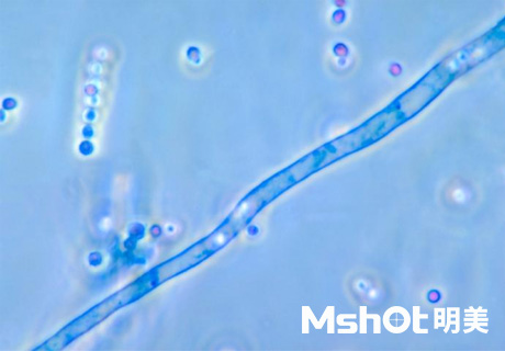 國產(chǎn)顯微鏡應用于煙曲霉檢測