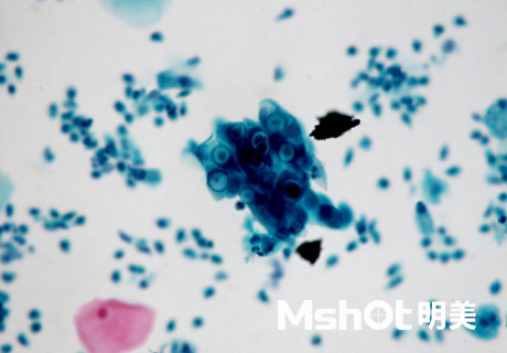 明美顯微鏡應用于支原體和衣原體檢測