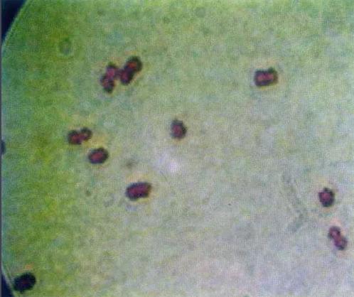 如何觀察腦膜炎球菌？|應用百科