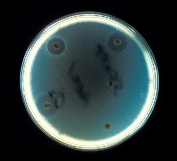 顯微鏡下的腸球菌|應用百科