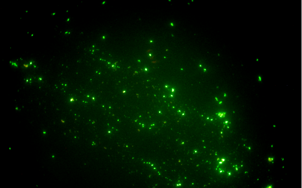 熒光生物顯微鏡應用于觀察陰道加德納菌|應用百科