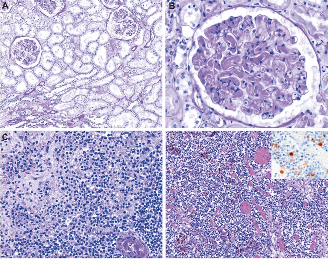 圖3:其他器官發(fā)現(xiàn) 圖3:其他器官發(fā)現(xiàn)