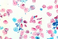 Һ����Ƭ�@΢�DƬ