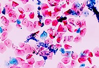 Һ����Ƭ�@΢�DƬ