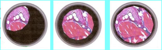 如何調(diào)試顯微鏡聚光鏡?