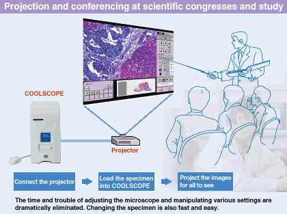 �@΢�R����ԭ��